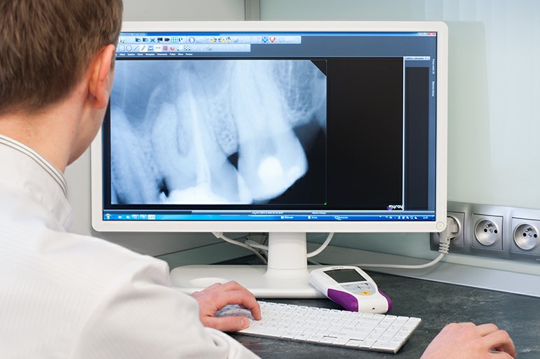 Stomatolog oglądający wyniki prześwietlenia zębów