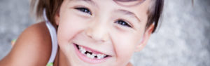 Dziecko z usuniętymi zębami mlecznymi
